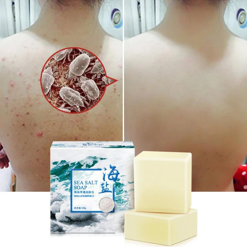 100g Removal Pimple Pore Acne Treatment Sea Salt Soap Cleaner Moisturizing Goat Milk Soap Face Care Wash Basis Soap TSLM1
100g Removal Pimple Pore Acne Treatment Sea Salt Soap Cleaner Moisturizing Goat Milk Soap Face Care Wash Basis Soap TSLM1