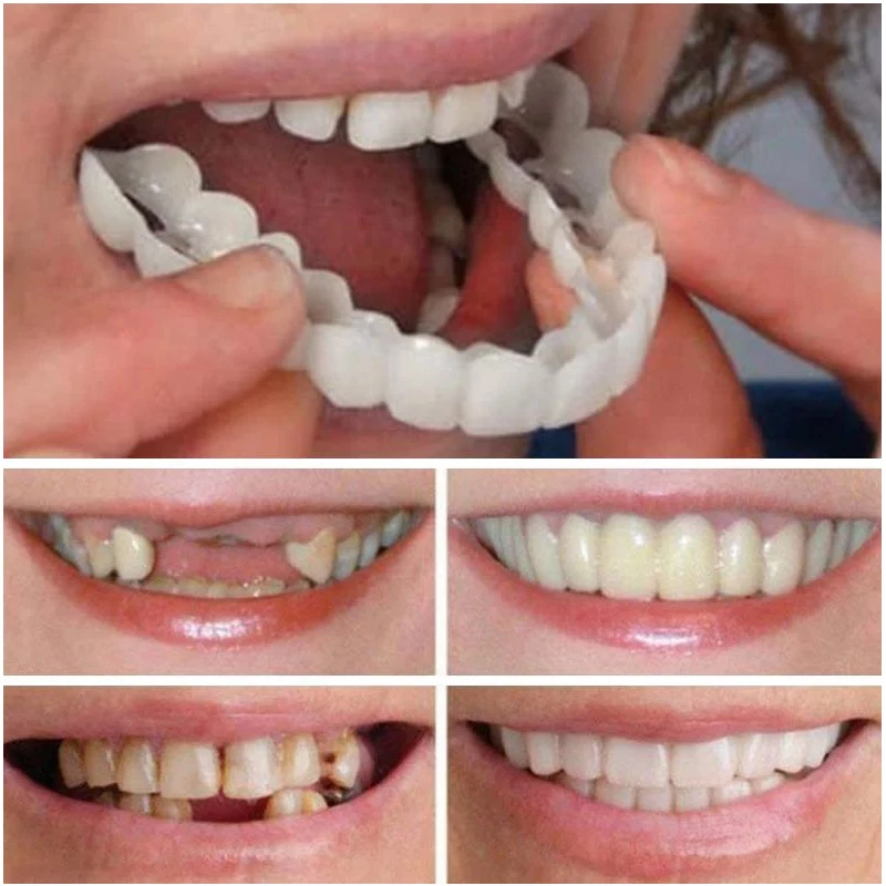 3PCS Simulation Braces Denture Upper Teeth Lower Teeth Box Keep Smile Comfort Fit Cosmetic Teeth Denture Teeth Top Veneer
3PCS Simulation Braces Denture Upper Teeth Lower Teeth Box Keep Smile Comfort Fit Cosmetic Teeth Denture Teeth Top Veneer