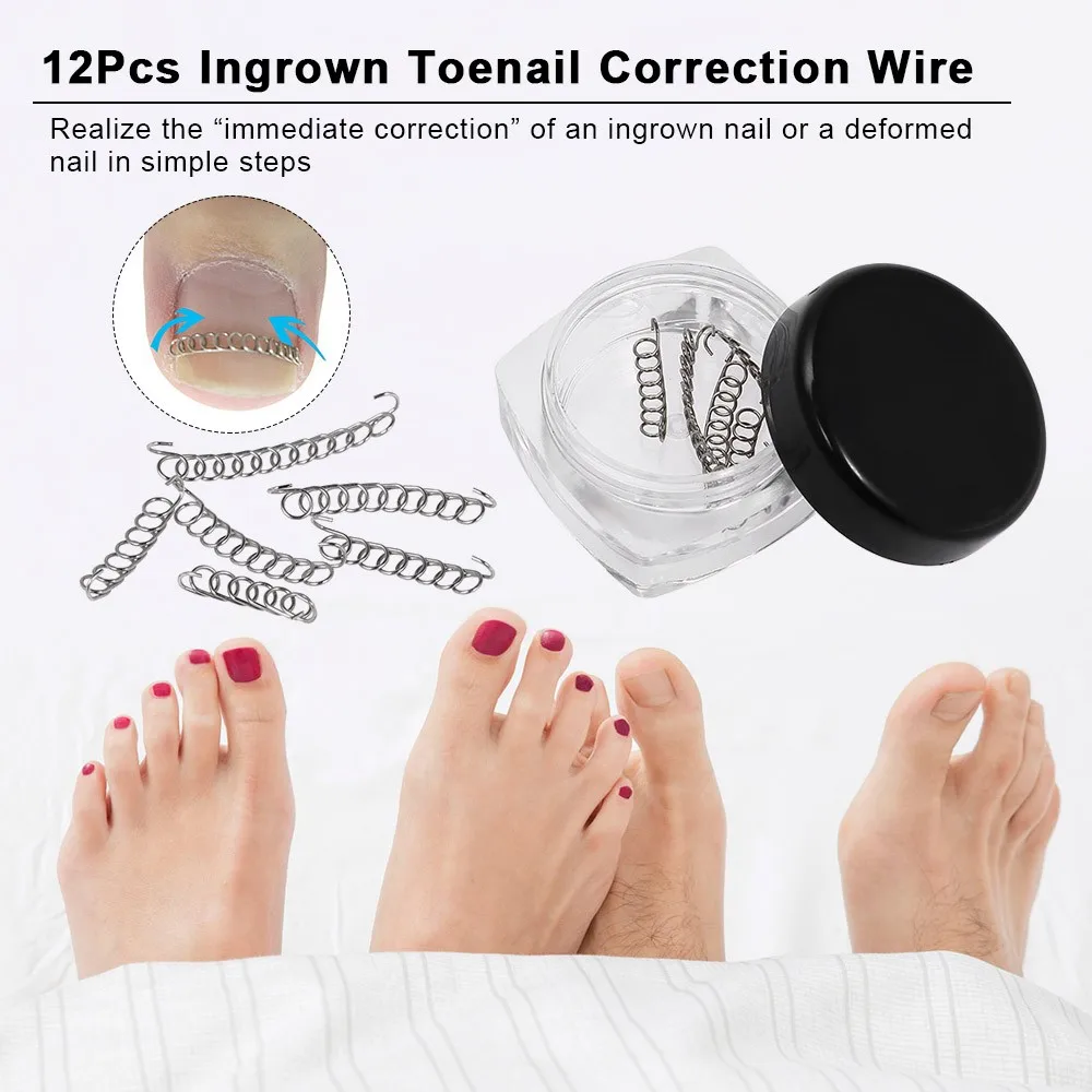 12Pcs Ingrown Toenail Correction Wire Fixer Ingrown Toe Nail Corrector Pedicure Treatment Foot Care Tool
12Pcs Ingrown Toenail Correction Wire Fixer Ingrown Toe Nail Corrector Pedicure Treatment Foot Care Tool