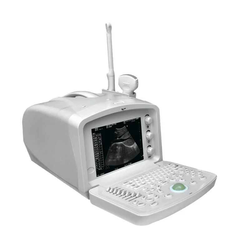 BT-UD61 Digital Portable Ultrasonic Diagnosis Equipment to Human portable Color Trolly Physio Ultrasound scanner Price Machine
BT-UD61 Digital Portable Ultrasonic Diagnosis Equipment to Human portable Color Trolly Physio Ultrasound scanner Price Machine