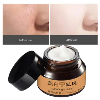 30ml Vitamin E Whitening Freckle Cream Strong Effect Powerful VE Face Essence Cream Light Yellow Spot Acne Cream Skin Care TSLM2
30ml Vitamin E Whitening Freckle Cream Strong Effect Powerful VE Face Essence Cream Light Yellow Spot Acne Cream Skin Care TSLM2