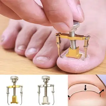 Ingrown Toenails Fixer Orthotics Toe Nail Recover Correction Tool Foot Nail Care Device Manicure Pedicure Set Machine Care Tool
Ingrown Toenails Fixer Orthotics Toe Nail Recover Correction Tool Foot Nail Care Device Manicure Pedicure Set Machine Care Tool