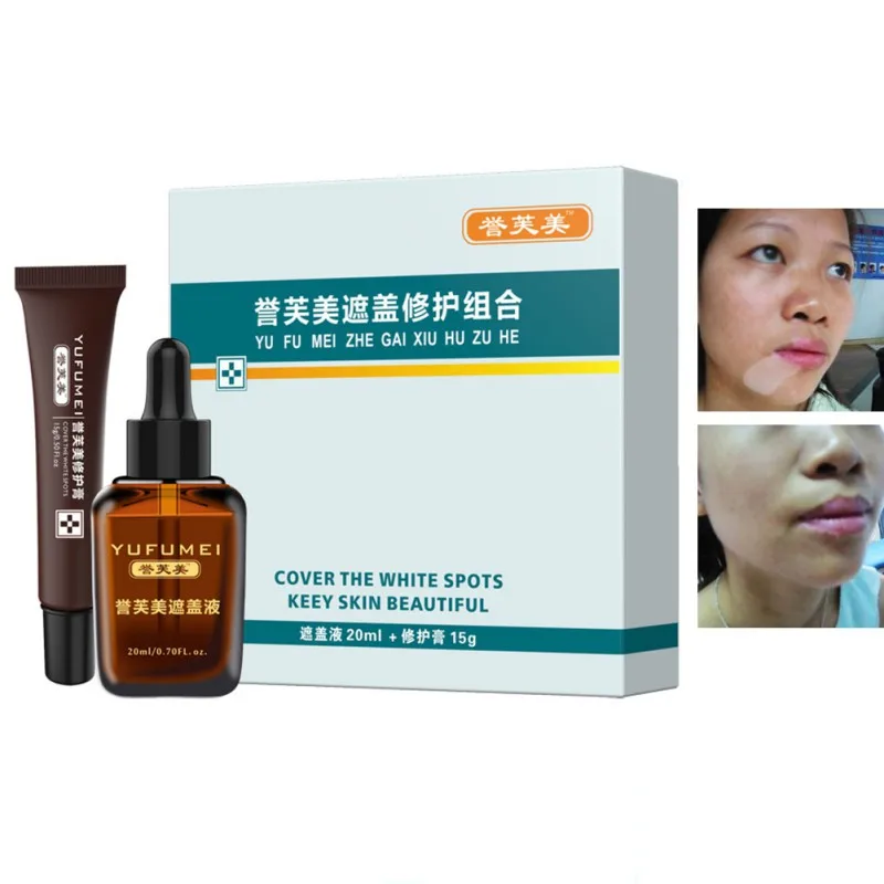 Professional Tattoo Concealer Vitiligo Scars Birthmarks Cover Plant Essence Set Tattoo Skin Repair Cream + Cover Liquid
Professional Tattoo Concealer Vitiligo Scars Birthmarks Cover Plant Essence Set Tattoo Skin Repair Cream + Cover Liquid