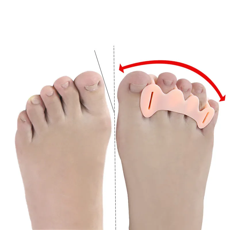 1Pair Soft Silicone Toe Separator Hallux Valgus Bunion Corrector Toe Straightener Unisex Bone Thumb Adjuster Protector Insoles
1Pair Soft Silicone Toe Separator Hallux Valgus Bunion Corrector Toe Straightener Unisex Bone Thumb Adjuster Protector Insoles