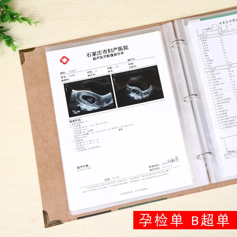 Pregnancy pregnancy test data collection storage book A4 A5 inch maternity checkup album
Pregnancy pregnancy test data collection storage book A4 A5 inch maternity checkup album