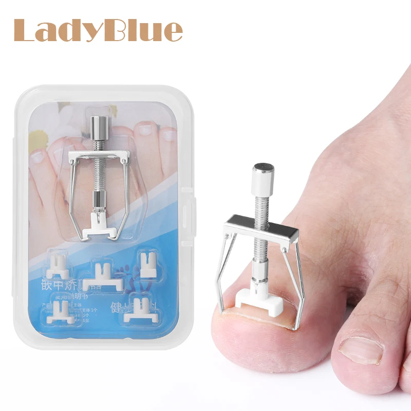 Ingrown Toe Nail Recover Correction Tool Pedicure Toenail Fixer Foot Nail Care Tool Orthotic Nail Corrector Pedicure Tool
Ingrown Toe Nail Recover Correction Tool Pedicure Toenail Fixer Foot Nail Care Tool Orthotic Nail Corrector Pedicure Tool
