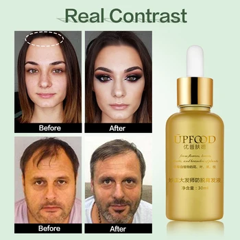 Hair Growth Essence Essential Oil Natural Herbal for Hair Growth Treatment Prevent Anti Hair Loss Hair Care Products Hair Tonic
Hair Growth Essence Essential Oil Natural Herbal for Hair Growth Treatment Prevent Anti Hair Loss Hair Care Products Hair Tonic