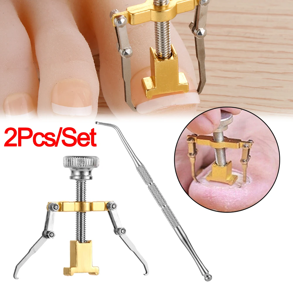 1Set Professional Effectiv Treatment Ingrown Toenail Correction Pedicure Tools Paronychia Foot Care Nail Recover Tools
1Set Professional Effectiv Treatment Ingrown Toenail Correction Pedicure Tools Paronychia Foot Care Nail Recover Tools