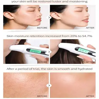 Salicylic Acid Sleeping Mask Oil-Control Acne Treatment Remove Skin head Blackhead Care Diluting Smallpox Mask black Clay T7R1
Salicylic Acid Sleeping Mask Oil-Control Acne Treatment Remove Skin head Blackhead Care Diluting Smallpox Mask black Clay T7R1