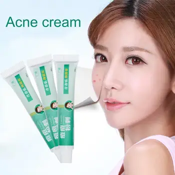 20g Acne Treatment Cream Nature Herbal Anti Acne Face Face Control Pores Whitening Remove Shrink Oil Scar Acne Cream Care G0B1 
20g Acne Treatment Cream Nature Herbal Anti Acne Face Face Control Pores Whitening Remove Shrink Oil Scar Acne Cream Care G0B1