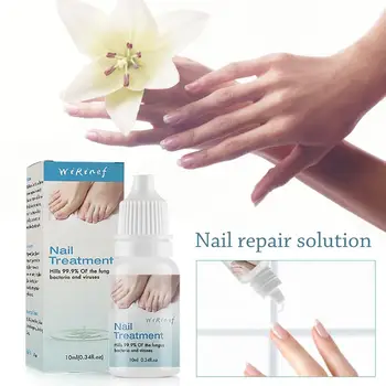 Nail Treatment Repair Liquid Natural And Safe Protect Nails Repair Liquid Nail Solution Essence For Fingernails 
Nail Treatment Repair Liquid Natural And Safe Protect Nails Repair Liquid Nail Solution Essence For Fingernails