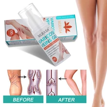 100ml Venous red blood streaks to repair earthworm hamstrings and bulge to relieve pain safflower ointment varicose cream
100ml Venous red blood streaks to repair earthworm hamstrings and bulge to relieve pain safflower ointment varicose cream