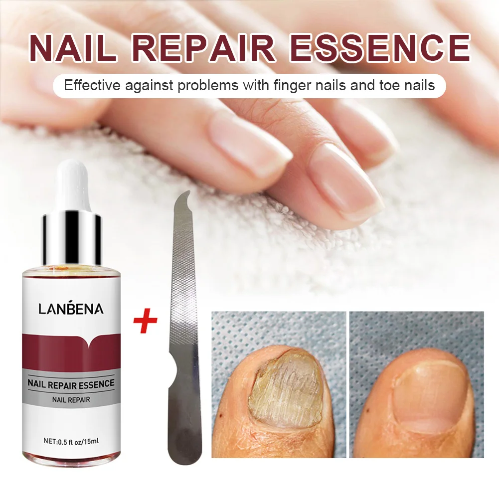 LANBENA Toenail Repair Essence для ногтей лечение грибка сыворотка онихомикоз трещины