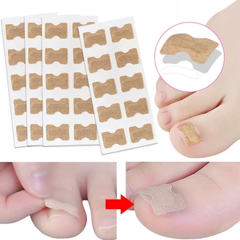 Toe Nail Corrector Sticker Paronychia Treatment Fixer Recover Elastic Patch Pedicure Foot Toe Ingrown Care Tools Glue Free
Toe Nail Corrector Sticker Paronychia Treatment Fixer Recover Elastic Patch Pedicure Foot Toe Ingrown Care Tools Glue Free