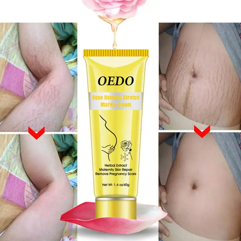 Maternity Skin Repair Cream Rose Remove Stretch Marks Cream Anti Wrinkle Anti Aging Remove Pregnancy Scars Body Skin Care TSLM1
Maternity Skin Repair Cream Rose Remove Stretch Marks Cream Anti Wrinkle Anti Aging Remove Pregnancy Scars Body Skin Care TSLM1