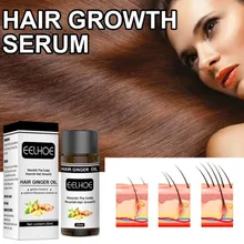 

Ginger Hair Growth Oil Products Huiles Essentielles Anticaida De Cabello Crescer Cabelo Pousse Cheveux Tratamientos Capilares