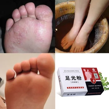 Foot Soaking Powder Sterilization Bacteriostatic Remove Foot Fungus Odor Foot Care Product 
Foot Soaking Powder Sterilization Bacteriostatic Remove Foot Fungus Odor Foot Care Product