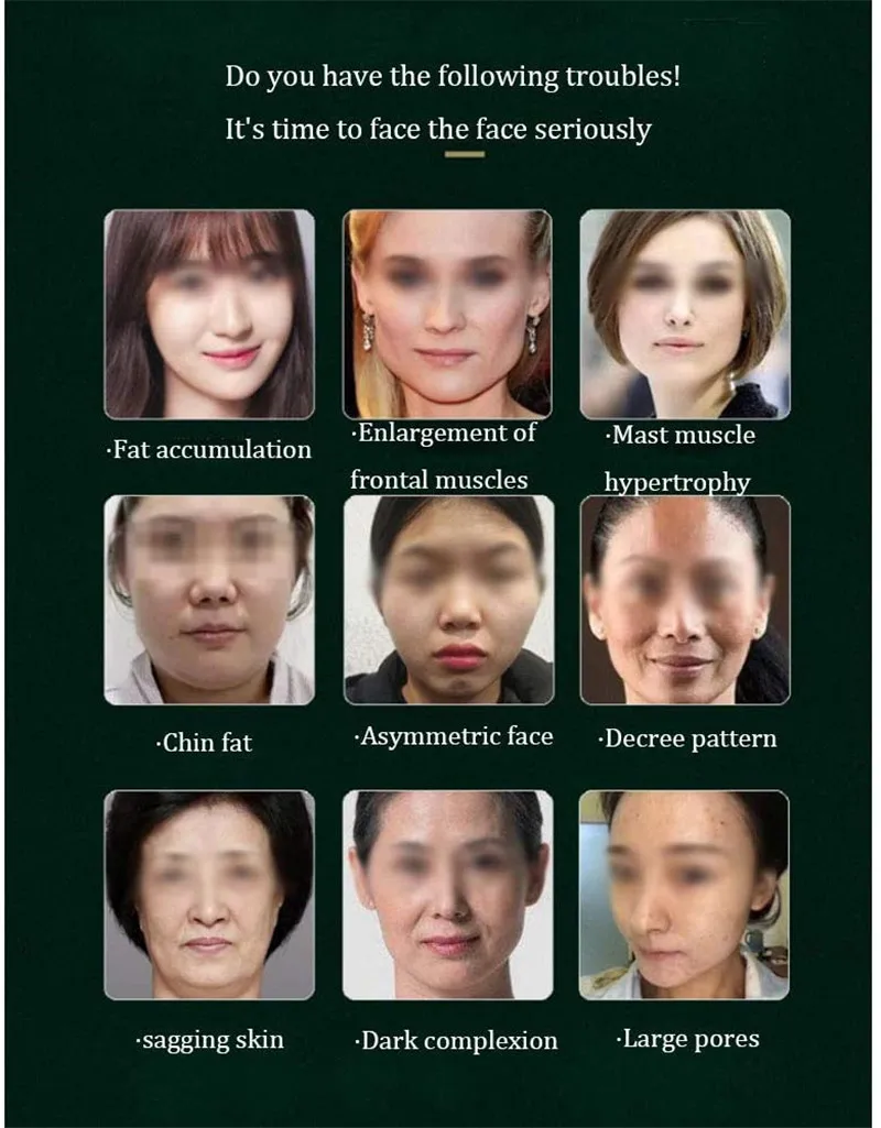 Face-Lift Device Slimming Therapy Vibration 2 Hb51e6c24257a4cad8843706b4560c2dcH