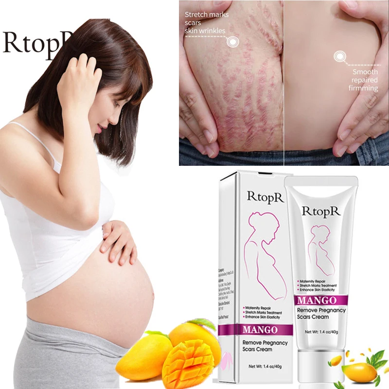 3PCS RtopR Pregnancy Scar Removal Cream Mango Non-irritating Women Pigment Correction Repair Body Gel Firm Brighten Stretch Mark
3PCS RtopR Pregnancy Scar Removal Cream Mango Non-irritating Women Pigment Correction Repair Body Gel Firm Brighten Stretch Mark