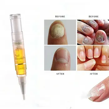 5ML Fungal Nail Repair Pen Effective Anti Fungal Nail Infection Biological Repair Restores Healthy Toe Nail Care
5ML Fungal Nail Repair Pen Effective Anti Fungal Nail Infection Biological Repair Restores Healthy Toe Nail Care