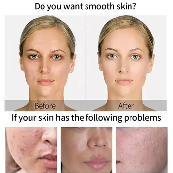 30ml Vitamin E Oil Moisturizing Massage Anti-oxidant Brightening Skin Care Skin Anti-wrinkle Anti VE Oil Serum Acne K5U6
30ml Vitamin E Oil Moisturizing Massage Anti-oxidant Brightening Skin Care Skin Anti-wrinkle Anti VE Oil Serum Acne K5U6