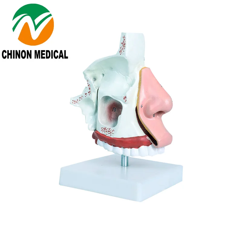 Chinon Nasal Anatomy Model Medical Science Student Teaching Tools Medical Supplies Human Nose Anatomical Model BIX-A1059
Chinon Nasal Anatomy Model Medical Science Student Teaching Tools Medical Supplies Human Nose Anatomical Model BIX-A1059