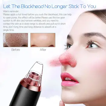 Electric Rechargeable Vacuum Blackhead Acne Cleaner Black Dot Pore Suction Remover cleaning Tool Set
Electric Rechargeable Vacuum Blackhead Acne Cleaner Black Dot Pore Suction Remover cleaning Tool Set