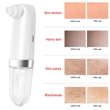 Original Cordless Electric Blackhead Remover USB Rechargeable Pore Vacuum Cleaner Water Cycling 6 Probe 3 Suction
Original Cordless Electric Blackhead Remover USB Rechargeable Pore Vacuum Cleaner Water Cycling 6 Probe 3 Suction