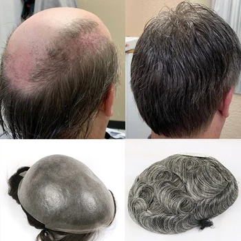 Eversilky PU Skin Human Hair Toupee for Men Brazilian Hair Pieces for Men with 10" x 8" PU Thin 0.06mm Skin,1B50 Color
Eversilky PU Skin Human Hair Toupee for Men Brazilian Hair Pieces for Men with 10" x 8" PU Thin 0.06mm Skin,1B50 Color