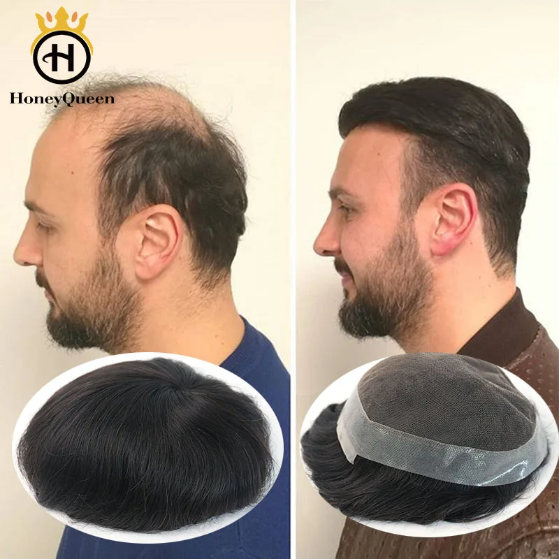 Men Hair Toupee System Natural Looking 100% European Human Hair Toupee French Lace With PU Replacement System Wig For Male Remy
Men Hair Toupee System Natural Looking 100% European Human Hair Toupee French Lace With PU Replacement System Wig For Male Remy