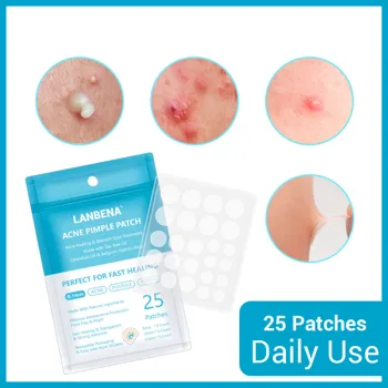 Pustule Welling Outburst Acne Stickers Invisible Waterproof Pimple Patchs Tea Tree Oil Mild Skin Care Treatment Tag 25pcs TSLM1
Pustule Welling Outburst Acne Stickers Invisible Waterproof Pimple Patchs Tea Tree Oil Mild Skin Care Treatment Tag 25pcs TSLM1