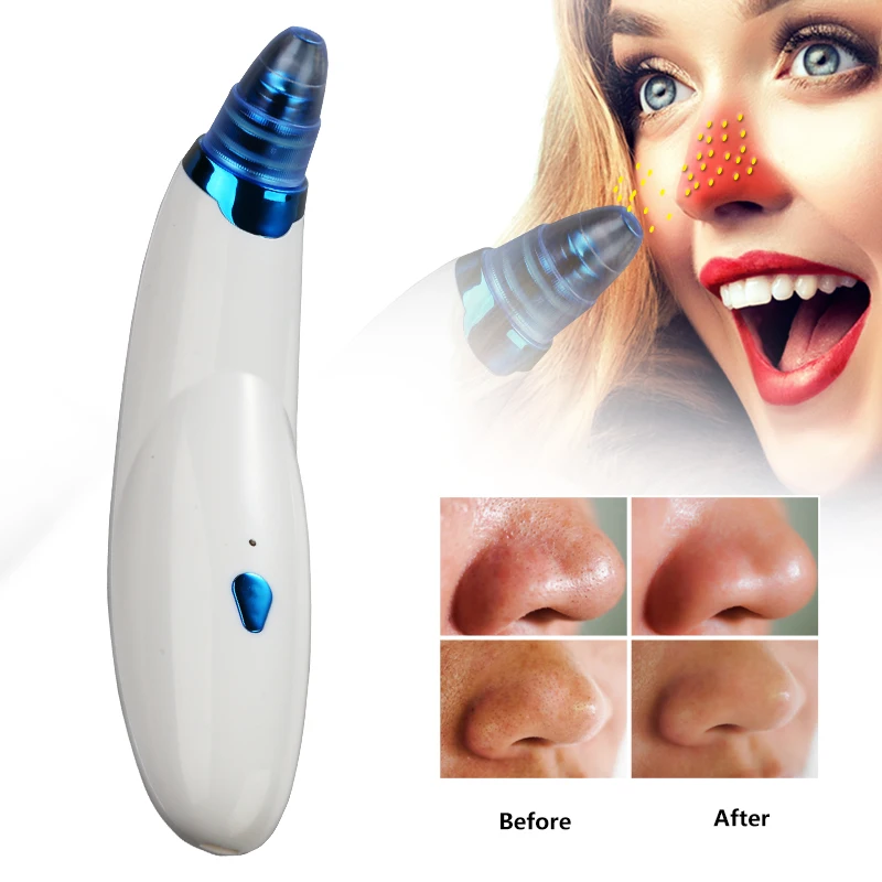 Blackhead Remover Face Deep Pore Vacuum Cleaner Acne Remover Pimple Removal Vacuum Suction Facial SPA Beauty Skin Care Tool Face
Blackhead Remover Face Deep Pore Vacuum Cleaner Acne Remover Pimple Removal Vacuum Suction Facial SPA Beauty Skin Care Tool Face