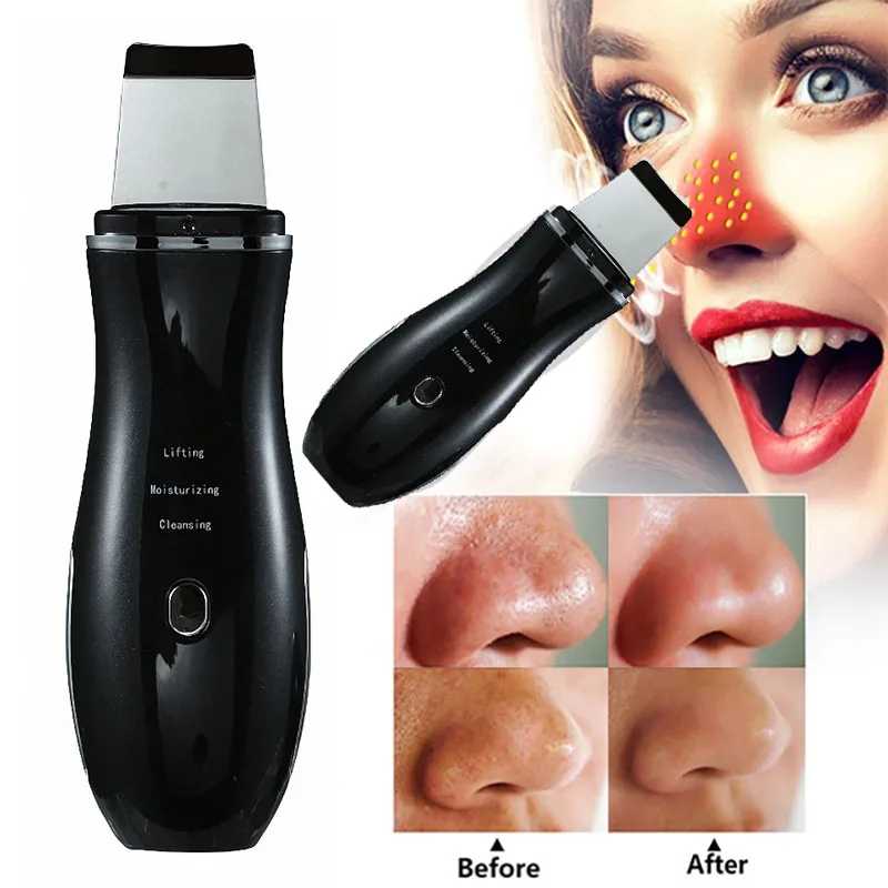Ultrasonic Deep Face Cleaning Peeling Machine Scrubber EMS Ion Rechargeable Skin Care Device Professional Facial Skin Beauty Ins
Ultrasonic Deep Face Cleaning Peeling Machine Scrubber EMS Ion Rechargeable Skin Care Device Professional Facial Skin Beauty Ins