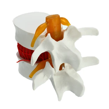 Human Anatomy Skeleton Spine Lumbar Disc Herniation Teaching Model Brain skull traumatic pistol school supplies medical instrume
Human Anatomy Skeleton Spine Lumbar Disc Herniation Teaching Model Brain skull traumatic pistol school supplies medical instrume