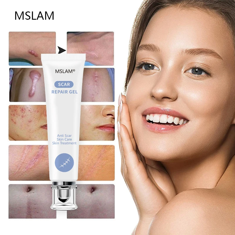MSLAM Advanced Skincare Formula Scar Gel, Acne Scar, Burn Scar, Surgical Scar, C-Section Scar and Keloid Scar Treatment 20g
MSLAM Advanced Skincare Formula Scar Gel, Acne Scar, Burn Scar, Surgical Scar, C-Section Scar and Keloid Scar Treatment 20g