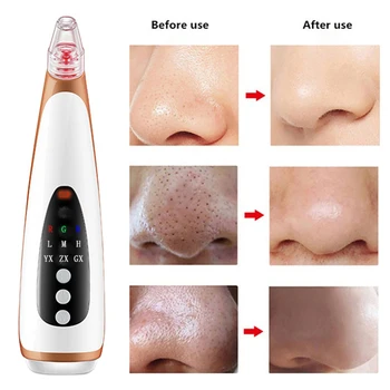 6in1 Facial Cleaning Acne Cosmetic Instrument Clean Red&Blue Light ABS Pore Contraction Remove Blackheads Black Head Cleaner
6in1 Facial Cleaning Acne Cosmetic Instrument Clean Red&Blue Light ABS Pore Contraction Remove Blackheads Black Head Cleaner