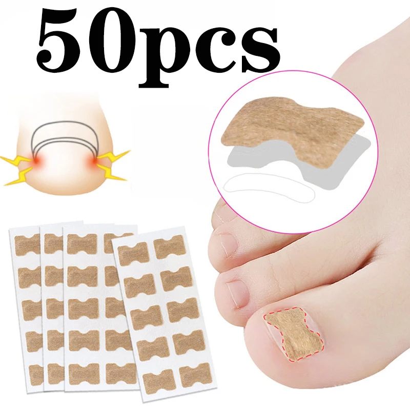 50 наклеек для лечения вросших ногтей лечение паронихии ремонт наклейки