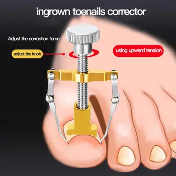 Ingrown Toenails Fixer Correction Pedicure Foot Toe Nail Care Tools File Elastic Patch Straightening Clip Brace Corrector Wire
Ingrown Toenails Fixer Correction Pedicure Foot Toe Nail Care Tools File Elastic Patch Straightening Clip Brace Corrector Wire