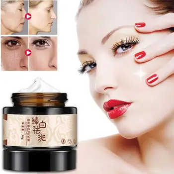 Herbal Acne Cream Acne Scars Blackhead Removal Cream Lightening Hydroquinone Serum Face Stain Acne Whitening Cream Fading T H8Q9
Herbal Acne Cream Acne Scars Blackhead Removal Cream Lightening Hydroquinone Serum Face Stain Acne Whitening Cream Fading T H8Q9