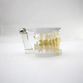 Dental Oral Care Tooth Teeth Model Dental Orthodontic Model for Patient Communication Dentist Study Model
Dental Oral Care Tooth Teeth Model Dental Orthodontic Model for Patient Communication Dentist Study Model