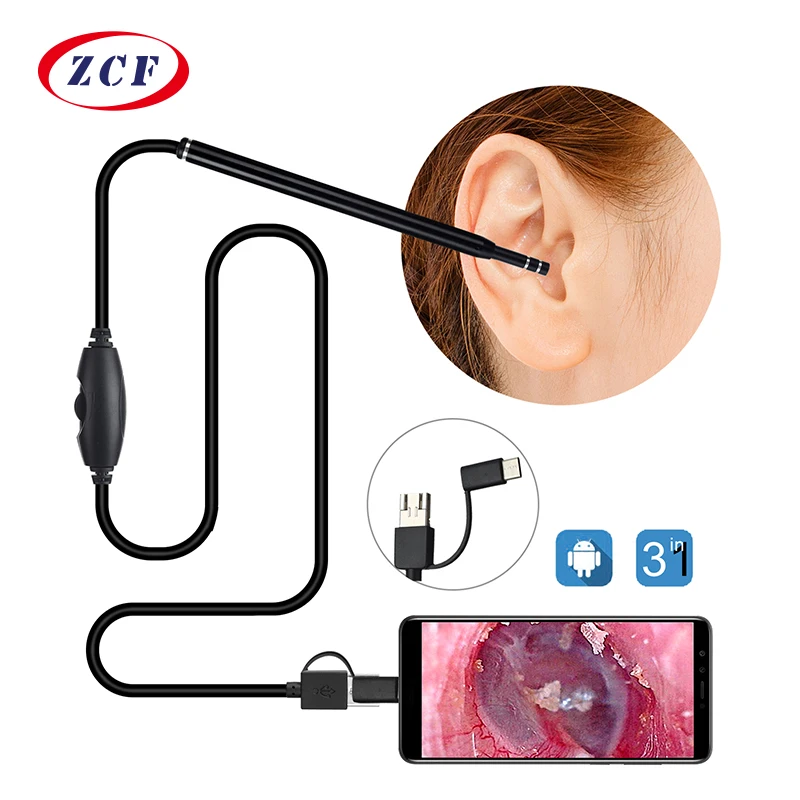 5.5mm 3 in 1 Ear cleaner camera android endoscope camera usb otoscope borescope type-c ear otoscope medical ear picker
5.5mm 3 in 1 Ear cleaner camera android endoscope camera usb otoscope borescope type-c ear otoscope medical ear picker