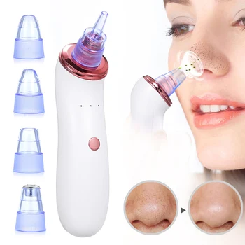 Electric Blackhead Remover Cleaner Blackhead Suction Device with 5 in 1 Pimple Zit Comedone Extractor Tool Acne Removal Kit
Electric Blackhead Remover Cleaner Blackhead Suction Device with 5 in 1 Pimple Zit Comedone Extractor Tool Acne Removal Kit