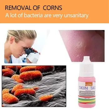 10 Ml Body Warts Treatment Cream Skin Tag Remover Foot Corn Genital Warts Care Foot Plantar Ointment Dropshopping Remove Cr W4Y0
10 Ml Body Warts Treatment Cream Skin Tag Remover Foot Corn Genital Warts Care Foot Plantar Ointment Dropshopping Remove Cr W4Y0