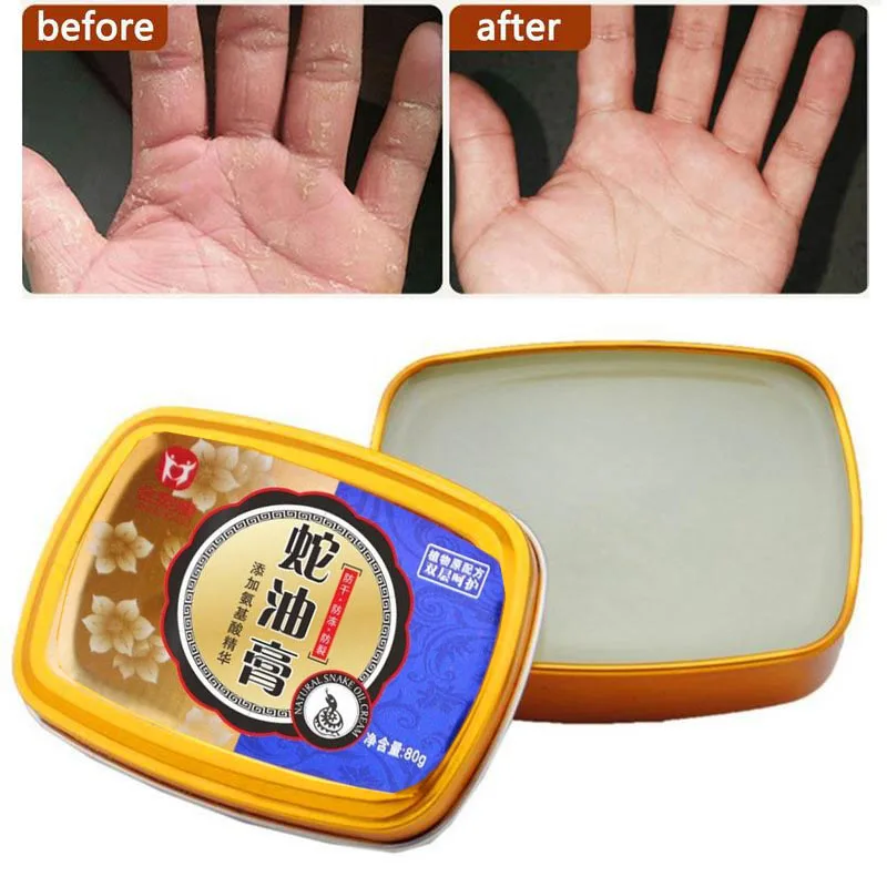 Snake Oil Repair Hand Cream Moisturizing Anti-aging Antibacterial Anti-chapping Whitening Hand Cream Skin Care Nourishing Cream
Snake Oil Repair Hand Cream Moisturizing Anti-aging Antibacterial Anti-chapping Whitening Hand Cream Skin Care Nourishing Cream