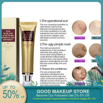 LANBENA 30g Acne Scar Repairing Face Cream Skin Care Acne Spots Removal Cream Acne Spots Scar Blemish Marks Treatment
LANBENA 30g Acne Scar Repairing Face Cream Skin Care Acne Spots Removal Cream Acne Spots Scar Blemish Marks Treatment