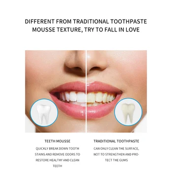 Mint Teeth Cleaning Mousse Toothpaste Remove Tooth Stains Remove Tea Tooth Odor Foam Toothpaste Teeth Whitening Oral Hygiene
Mint Teeth Cleaning Mousse Toothpaste Remove Tooth Stains Remove Tea Tooth Odor Foam Toothpaste Teeth Whitening Oral Hygiene