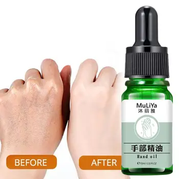 10ml Liquid Serum Moisture Whitening Hand Cream White Gentle Hand Skin Anti-Drying Anti-Crack Hands Feet Oil
10ml Liquid Serum Moisture Whitening Hand Cream White Gentle Hand Skin Anti-Drying Anti-Crack Hands Feet Oil