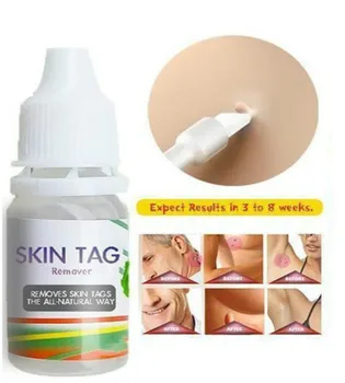 10ml Skin Tag Remover Skin Tags Genital Wart Remover Foot Care Cream Treatment Foot Corn Removal Blackhead Remover
10ml Skin Tag Remover Skin Tags Genital Wart Remover Foot Care Cream Treatment Foot Corn Removal Blackhead Remover