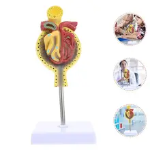 1pc Human Glomerulus Medical Model Teaching Glomerulus Anatomical Model with Base
1pc Human Glomerulus Medical Model Teaching Glomerulus Anatomical Model with Base