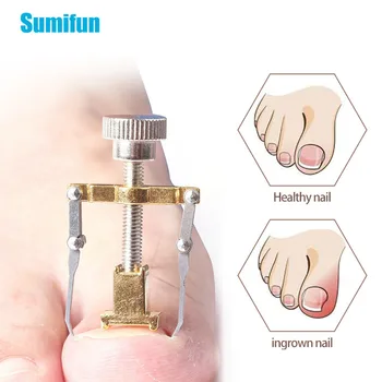 1Pcs Foot Pedicure Recover Ingrown Toe Nail Correction Toe Paronychia Nail Brace Tool Pedicure Nail Tool Toenails C1670-C1671
1Pcs Foot Pedicure Recover Ingrown Toe Nail Correction Toe Paronychia Nail Brace Tool Pedicure Nail Tool Toenails C1670-C1671